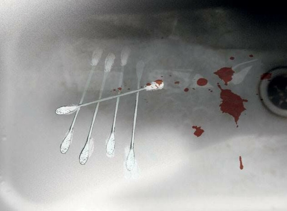 Jeg er Johns prostata