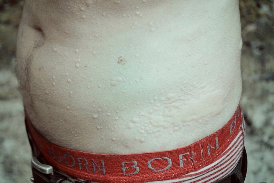 Sådan føles det at blive angrebet af en flok bier