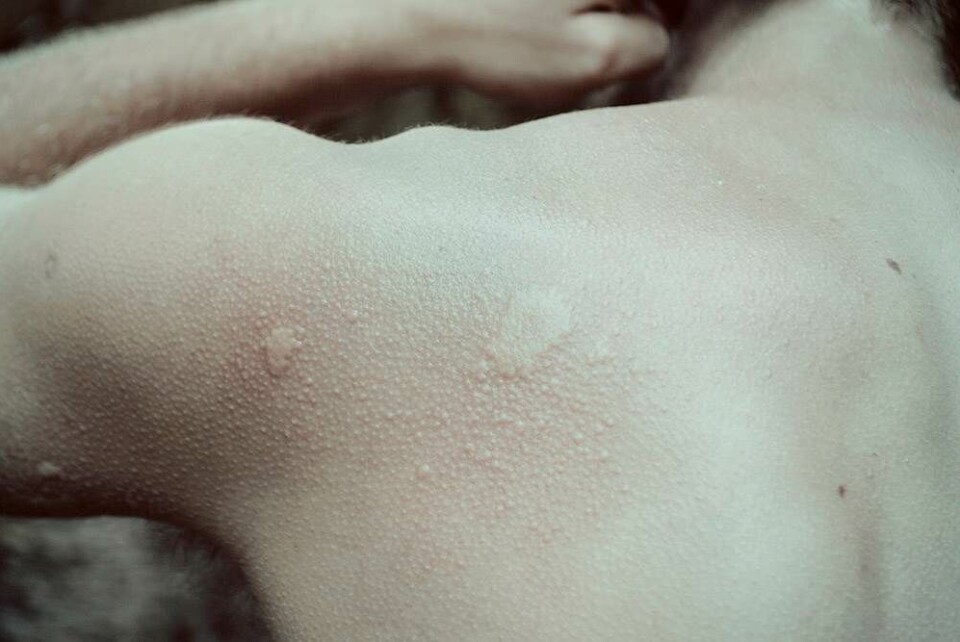 Sådan føles det at blive angrebet af en flok bier